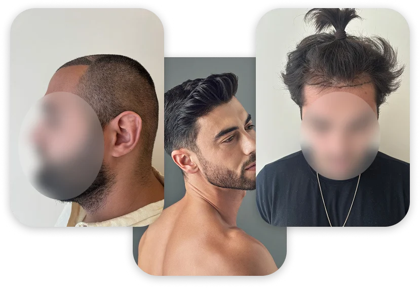 Tratamento Capilar - Estética Santa Beleza