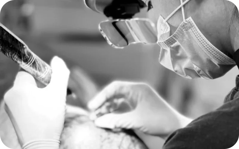Tratamento Alopecia Androgenética Masculina